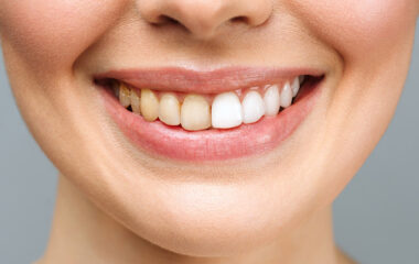 Kozmetik Diş Hekimliği